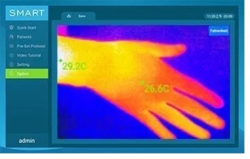 Thermal Imaging Image